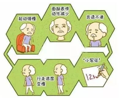 經顱磁刺激療法_如何護理帕金森病患者 